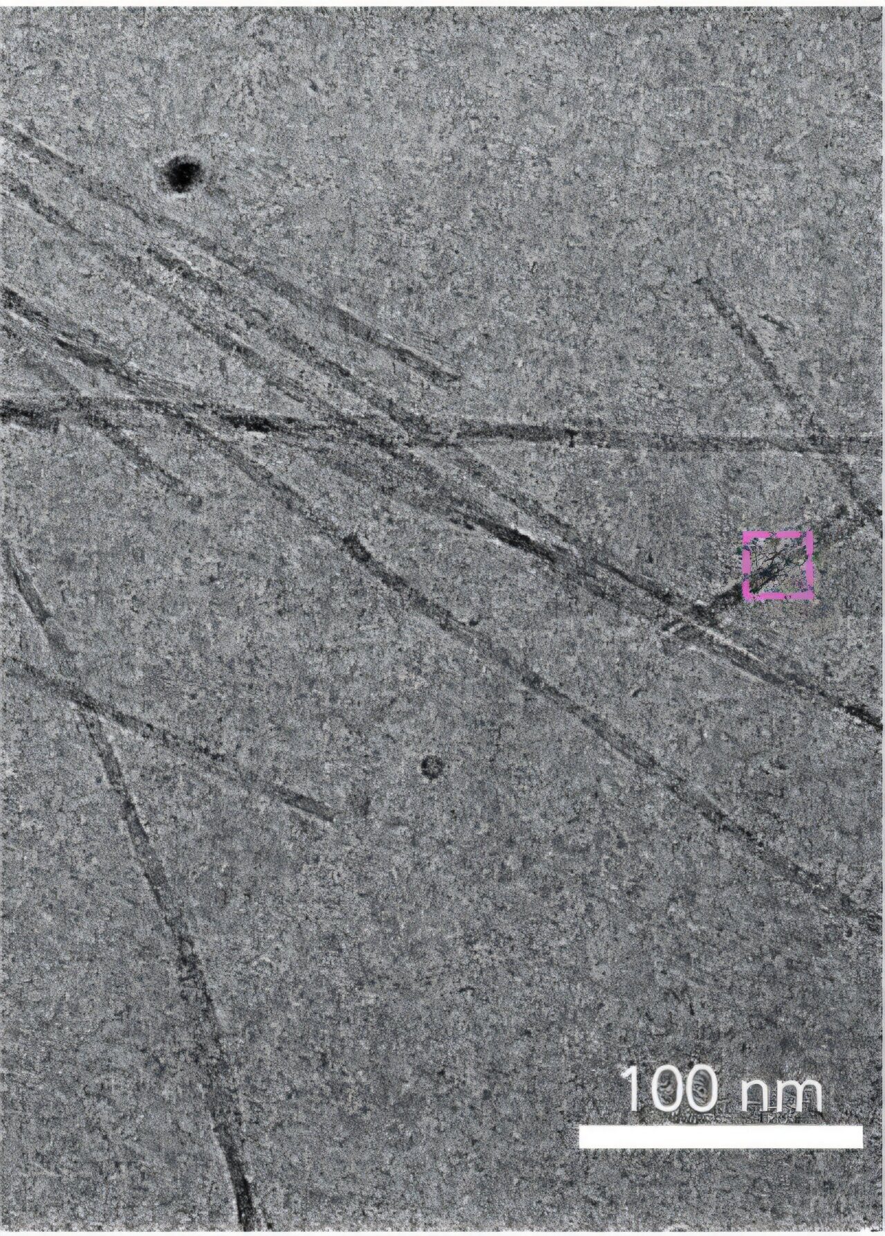 Electron Microscope image of tau proteins (long dark sticks in grey background), with scale bar reading "100 nm."